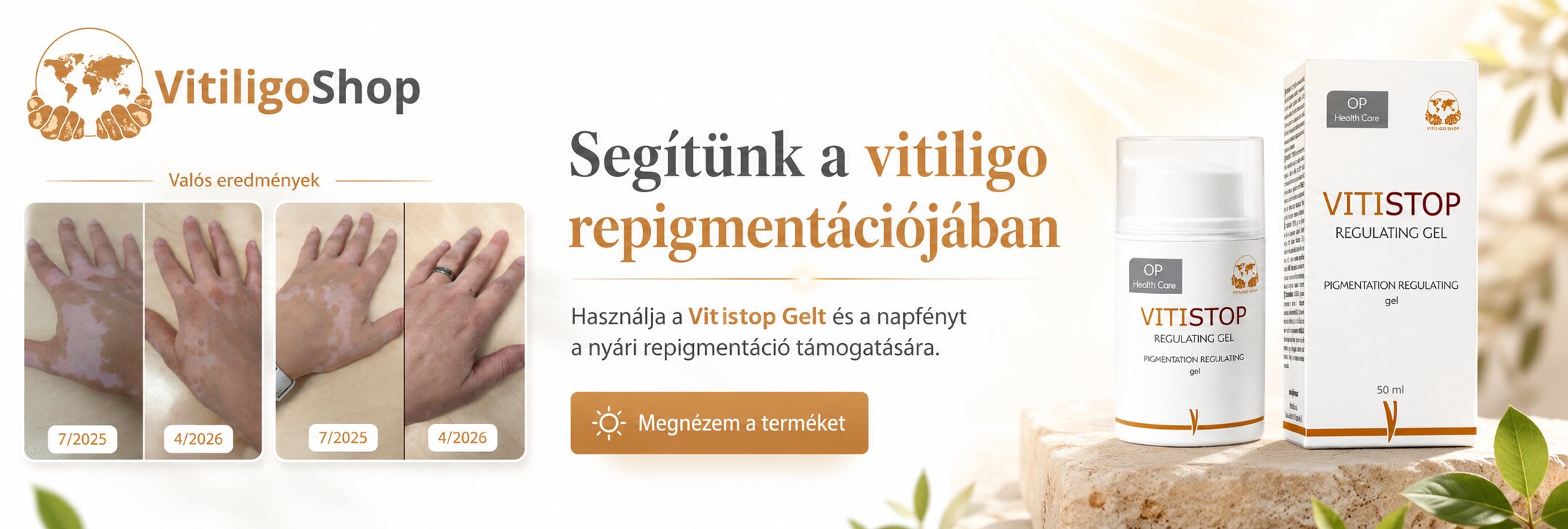 Vitistop Gel Vitiligo