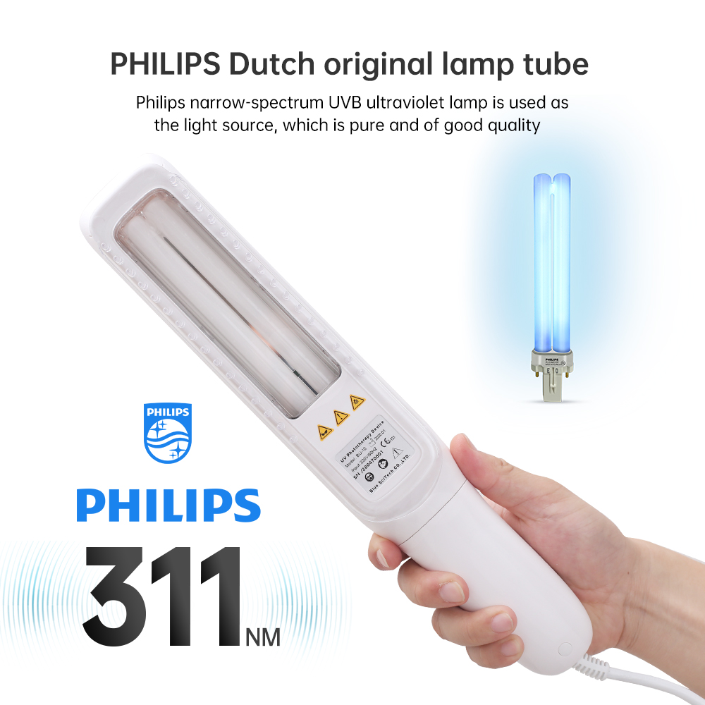 UVB lamp for seborrhoea