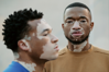 Vitiligo a divatban: a sokféleség szépsége | Vitiligoshop.hu