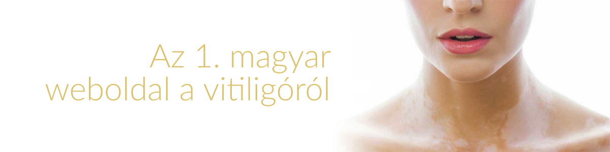Az 1. magyar     weboldal a vitiligóról  