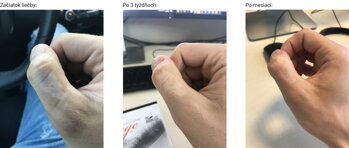 A KEZELÉS FOLYAMATA A KEZELÉS FOLYAMATA